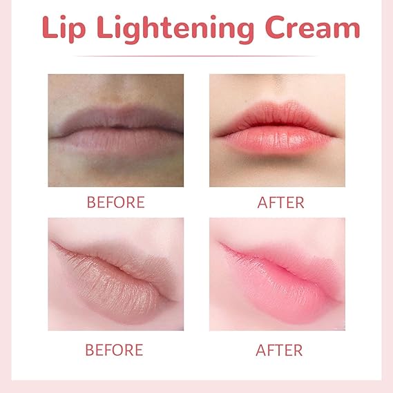 Lips Pink Fresh Fast Lightening Bleaching Cream Balm Treatment Remove Dark Lips