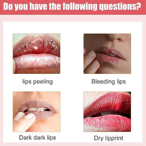 Lips Pink Fresh Fast Lightening Bleaching Cream Balm Treatment Remove Dark Lips